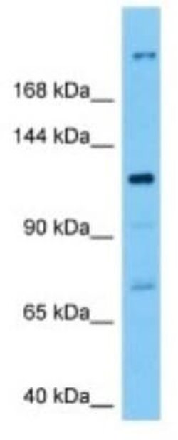 TMC3 Rabbit anti-Human, Polyclonal, Novus Biologicals:Antibodies:Primary